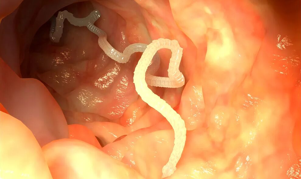 Luminal Würmer infizéieren den Darm
