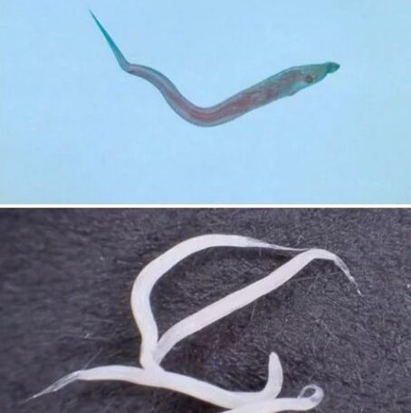 Aarte vu Parasiten am mënschleche Kierper