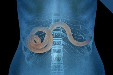 Parasiten am mënschleche Kierper