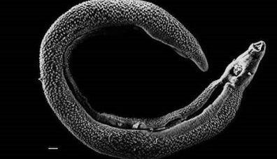 Wéi eng Parasiten kënnen an enger Persoun liewen