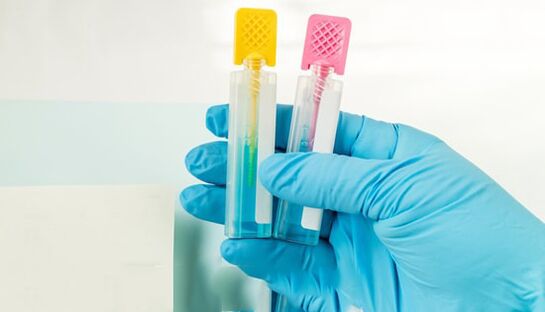 Parasit Diagnostik Methoden