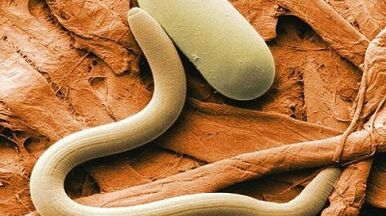 Parasiten am mënschleche Kierper